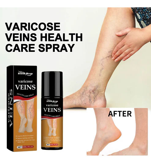 BEE VENOM VARICOSE VEINS RELIEF SPRAY (BUY 1 GET 1 FREE)(PACK OF 2)
